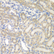 AUH Antibody - Immunohistochemistry of paraffin-embedded rat kidney tissue.
