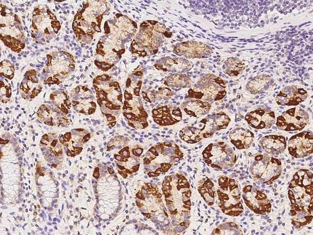 AUH Antibody - Immunochemical staining of human AUH in human stomach with rabbit polyclonal antibody at 1:300 dilution, formalin-fixed paraffin embedded sections.