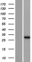 AUH Protein - Western validation with an anti-DDK antibody * L: Control HEK293 lysate R: Over-expression lysate