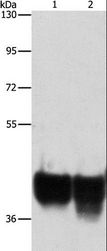 AUP1 Antibody - Western blot analysis of HeLa and 293T cell, using AUP1 Polyclonal Antibody at dilution of 1:500.