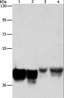 AUP1 Antibody - Western blot analysis of HeLa and 293T cell, mouse liver tissue and NIH/3T3 cell, using AUP1 Polyclonal Antibody at dilution of 1:500.