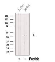 AUP1 Antibody - Western blot analysis of extracts of Jurkat cells using AUP1 antibody. The lane on the left was treated with blocking peptide.