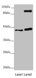 AURKA / Aurora-A Antibody - Western blot All Lanes :AURKA antibody at 2 ug/ml Lane 1 : NIH/3T3 whole cell lysate Lane 2 : HT29 whole cell lysate Secondary Goat polyclonal to rabbit IgG at 1/10000 dilution Predicted band size: 46 kDa Observed band size: 46,100 kDa