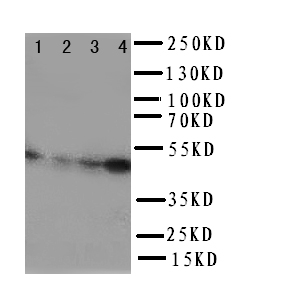 AURKA / Aurora-A Antibody - WB of AURKA / Aurora-A antibody. Lane 1: SKOV Cell Lysate. Lane 2: 22RV1 Cell Lysate. Lane 3: HELA Cell Lysate . Lane 4: JURKAT Cell Lysate.