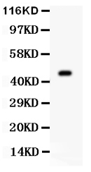 AURKA / Aurora-A Antibody - anti-AURKA antibody, Western blotting All lanes: Anti AURKA at 0.5ug/mlWB: Mouse Ovary Tissue Lysate at 50ugPredicted bind size: 46KD Observed bind size: 46KD