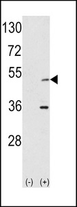 AURKA / Aurora-A Antibody - Western blot of AIK (arrow) using rabbit polyclonal hAIK-H105. 293 cell lysates (2 ug/lane) either nontransfected (Lane 1) or transiently transfected with the AIK gene (Lane 2) (Origene Technologies).