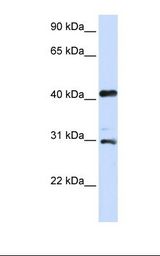 AURKA / Aurora-A Antibody - 293T cell lysate. Antibody concentration: 1.0 ug/ml. Gel concentration: 12%.  This image was taken for the unconjugated form of this product. Other forms have not been tested.