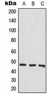AURKA / Aurora-A Antibody - Western blot analysis of Aurora A expression in MCF7 (A); SP2/0 (B); H9C2 (C) whole cell lysates.