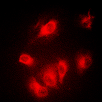 AURKA / Aurora-A Antibody - Immunofluorescent analysis of Aurora A staining in MCF7 cells. Formalin-fixed cells were permeabilized with 0.1% Triton X-100 in TBS for 5-10 minutes and blocked with 3% BSA-PBS for 30 minutes at room temperature. Cells were probed with the primary antibody in 3% BSA-PBS and incubated overnight at 4 C in a humidified chamber. Cells were washed with PBST and incubated with a DyLight 594-conjugated secondary antibody (red) in PBS at room temperature in the dark. DAPI was used to stain the cell nuclei (blue).