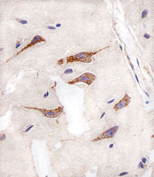 AURKA / Aurora-A Antibody - Immunohistochemical of paraffin-embedded H. brain section using AURKA Antibody. Antibody was diluted at 1:25 dilution. A peroxidase-conjugated goat anti-rabbit IgG at 1:400 dilution was used as the secondary antibody, followed by DAB staining.