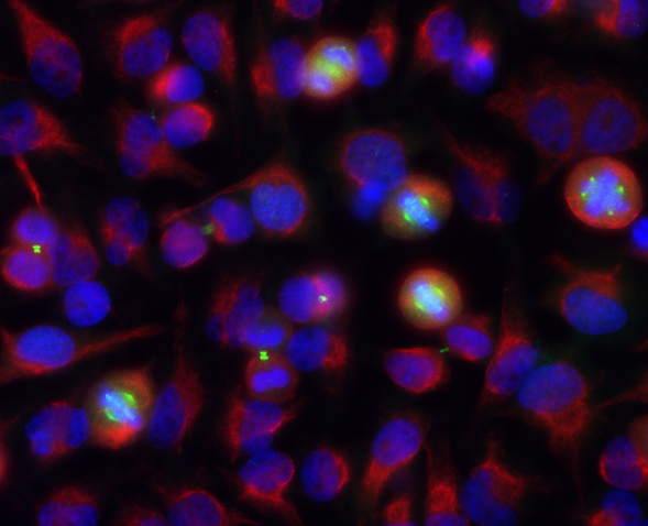 AURKA / Aurora-A Antibody - Shows HeLa cell cultures stained with AURKA / Aurora-A antibody antibody (green). Aurora A localizes in spindle poles and mitotic spindles at anaphase and concentrates on the midbody between the two daughter cells during telophase. Counterstained is a chicken polyclonal antibody against Vimentin (red). Blue is a DNA stain.