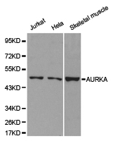 AURKA / Aurora-A Antibody - Western blot of extracts of various cell lines, using AURKA antibody.