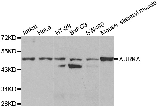 AURKA / Aurora-A Antibody - Western blot analysis of extracts of various cell lines.