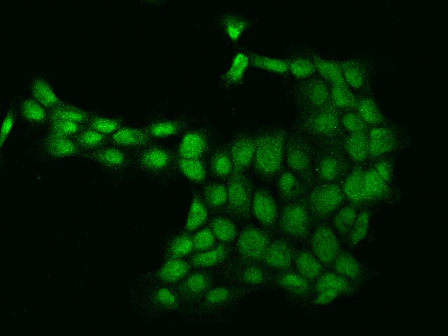 AURKA / Aurora-A Antibody - Immunofluorescence staining of AURKA in A431 cells. Cells were fixed with 4% PFA, permeabilzed with 0.1% Triton X-100 in PBS, blocked with 10% serum, and incubated with rabbit anti-Human AURKA polyclonal antibody (dilution ratio 1:200) at 4°C overnight. Then cells were stained with the Alexa Fluor 488-conjugated Goat Anti-rabbit IgG secondary antibody (green). Positive staining was localized to Nucleus and Cytoplasm.