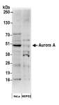AURKA / Aurora-A Antibody - Detection of human Aurora A in HeLa and HEPG2 whole cell lysates