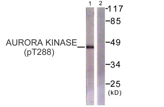 AURKA / Aurora-A Antibody - Western blot analysis of lysates from 293 cells treated with serum 20% 15', using Aurora Kinase (Phospho-Thr288) Antibody. The lane on the right is blocked with the phospho peptide.