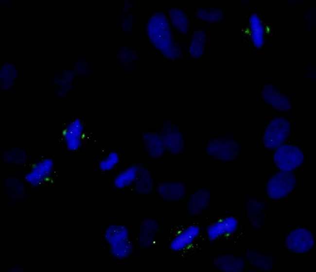 AURKA / Aurora-A Antibody - Detection of Human Phospho-Aurora A (T288) by Immunocytochemistry. Samples: NBF-fixed asynchronous HeLa cells. Antibody: Affinity purified rabbit anti-Phospho-Aurora A (T288) used at a dilution of 1:250. Detection: Anti-rabbit IgG-FITC conjugated used at a dilution of 1:100.