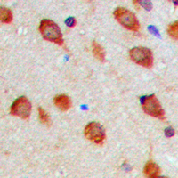 AURKA / Aurora-A Antibody - Immunohistochemical analysis of Aurora A (pT288) staining in human brain formalin fixed paraffin embedded tissue section. The section was pre-treated using heat mediated antigen retrieval with sodium citrate buffer (pH 6.0). The section was then incubated with the antibody at room temperature and detected using an HRP-conjugated compact polymer system. DAB was used as the chromogen. The section was then counterstained with hematoxylin and mounted with DPX.