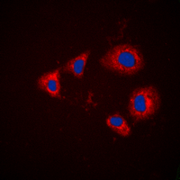 AURKA / Aurora-A Antibody - Immunofluorescent analysis of Aurora A (pT288) staining in HEK293T cells. Formalin-fixed cells were permeabilized with 0.1% Triton X-100 in TBS for 5-10 minutes and blocked with 3% BSA-PBS for 30 minutes at room temperature. Cells were probed with the primary antibody in 3% BSA-PBS and incubated overnight at 4 deg C in a humidified chamber. Cells were washed with PBST and incubated with a DyLight 594-conjugated secondary antibody (red) in PBS at room temperature in the dark. DAPI was used to stain the cell nuclei (blue).
