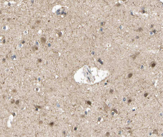 AURKA / Aurora-A Antibody - 1:200 staining human brain tissue by IHC-P. The tissue was formaldehyde fixed and a heat mediated antigen retrieval step in citrate buffer was performed. The tissue was then blocked and incubated with the antibody for 1.5 hours at 22°C. An HRP conjugated goat anti-rabbit antibody was used as the secondary.