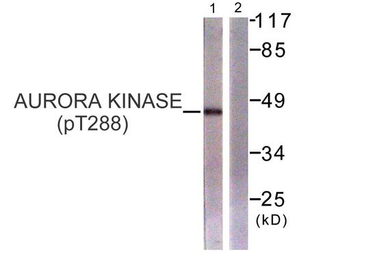 AURKA / Aurora-A Antibody - Western blot analysis of extracts from 293 cells, treated with serum (20%, 15mins), using Aurora Kinase (Phospho-Thr288) antibody.
