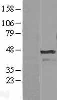 AURKA / Aurora-A Protein - Western validation with an anti-DDK antibody * L: Control HEK293 lysate R: Over-expression lysate