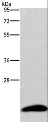 AURKAIP1 / AKIP Antibody - Western blot analysis of Human testis tissue, using AURKAIP1 Polyclonal Antibody at dilution of 1:600.