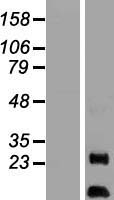 AURKAIP1 / AKIP Protein - Western validation with an anti-DDK antibody * L: Control HEK293 lysate R: Over-expression lysate