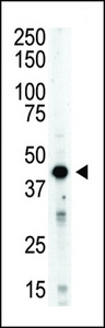 AURKB / Aurora-B Antibody - The STK12 polyclonal antibody is used in Western blot to detect STK12 in mouse spleen tissue lysate.