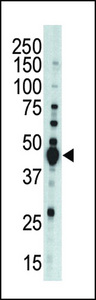 AURKB / Aurora-B Antibody - The STK12 polyclonal antibody is used in Western blot to detect STK12 in mouse brain tissue lysate.