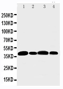 AURKB / Aurora-B Antibody - WB of AURKB / Aurora-B antibody. All lanes: Anti-AURKB at 0.5ug/ml. Lane 1: Rat Liver Tissue Lysate at 40ug. Lane 2: 22RV Whole Cell Lysate at 40ug. Lane 3: HELA Whole Cell Lysate at 40ug. Lane 4: SW620 Whole Cell Lysate at 40ug. Predicted bind size: 39KD. Observed bind size: 39KD.