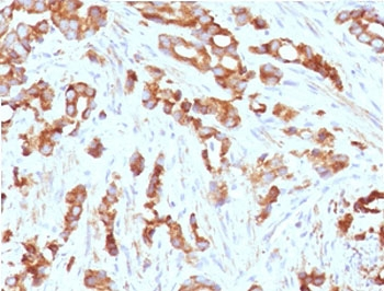 AURKB / Aurora-B Antibody - IHC testing of FFPE human prostate tissue with AURKB antibody (clone ARRK2-1). HIER: boil tissue sections in pH6, 10mM citrate buffer, for 10-20 min followed by cooling at RT for 20 min.