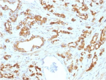 AURKB / Aurora-B Antibody - IHC testing of FFPE human prostate tissue with Aurora B antibody (clone AURKB/1593). HIER: boil tissue sections in pH6, 10mM citrate buffer, for 10-20 min followed by cooling at RT for 20 min.