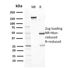 AURKB / Aurora-B Antibody - SDS-PAGE analysis of purified, BSA-free Aurora B antibody (clone AURKB/1593) as confirmation of integrity and purity.
