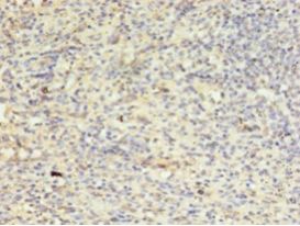 AURKB / Aurora-B Antibody - Immunohistochemistry of paraffin-embedded human spleen tissue using antibody at 1:100 dilution.  This image was taken for the unconjugated form of this product. Other forms have not been tested.