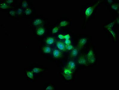 AURKB / Aurora-B Antibody - Immunofluorescence staining of Hela cells with AURKB Antibody at 1:166, counter-stained with DAPI. The cells were fixed in 4% formaldehyde, permeabilized using 0.2% Triton X-100 and blocked in 10% normal Goat Serum. The cells were then incubated with the antibody overnight at 4°C. The secondary antibody was Alexa Fluor 488-congugated AffiniPure Goat Anti-Rabbit IgG(H+L).