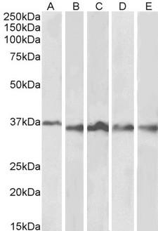 AURKB / Aurora-B Antibody - Goat Anti-Aurora Kinase B Antibody (1µg/ml) staining of Thymus (A), Lymph Node (B), Tonsil (C), Spleen (D) and Testis (E) lysates (35µg protein in RIPA buffer). Primary incubation was 1 hour. Detected by chemiluminescencence.