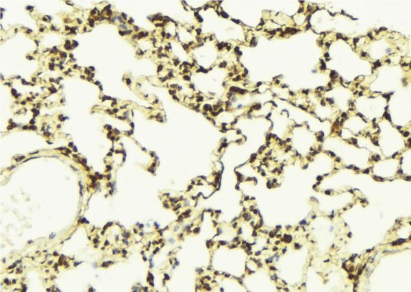 AURKB / Aurora-B Antibody - 1:100 staining mouse lung tissue by IHC-P. The sample was formaldehyde fixed and a heat mediated antigen retrieval step in citrate buffer was performed. The sample was then blocked and incubated with the antibody for 1.5 hours at 22°C. An HRP conjugated goat anti-rabbit antibody was used as the secondary.