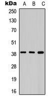 AURKB / Aurora-B Antibody - Western blot analysis of Aurora B expression in HepG2 (A); Raw264.7 (B); rat liver (C) whole cell lysates.