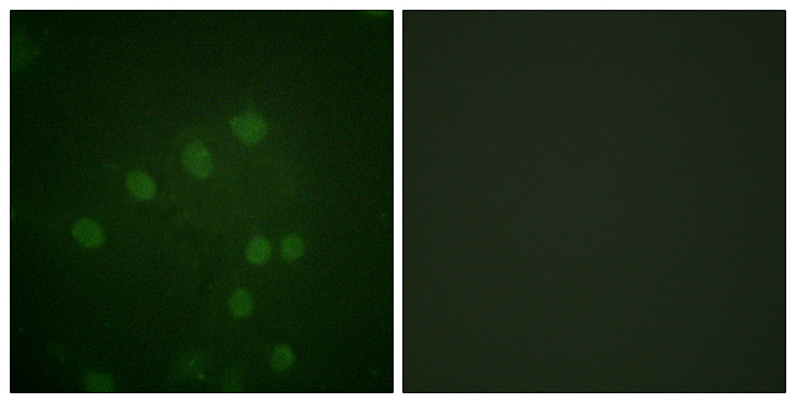 AURKB / Aurora-B Antibody - Immunofluorescence analysis of HepG2 cells, using AurB (Phospho-Thr232) Antibody. The picture on the right is blocked with the phospho peptide.