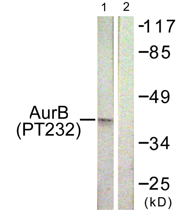 AURKB / Aurora-B Antibody - Western blot analysis of lysates from COS7 cells treated with Nocodazole 1ug/ml 16h, using AurB (Phospho-Thr232) Antibody. The lane on the right is blocked with the phospho peptide.