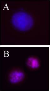 AURKB / Aurora-B Antibody - Untreated Hela cells (Panel A), or overnight nocodazole-treated Hela cells Panel B) stained with purified rabbit polyclonal antibody against phospho-Aurora B (Thr232), followed by Cy3 conjugated Donkey anti-rabbit IgG and DAPI.
