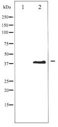 AURKB / Aurora-B Antibody - Western blot of AurB phosphorylation expression in Nocodazole treated COS7 whole cell lysates,The lane on the left is treated with the antigen-specific peptide.
