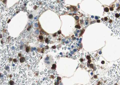 AURKB / Aurora-B Antibody - 1:100 staining human Bone marrow tissue by IHC-P. The tissue was formaldehyde fixed and a heat mediated antigen retrieval step in citrate buffer was performed. The tissue was then blocked and incubated with the antibody for 1.5 hours at 22°C. An HRP conjugated goat anti-rabbit antibody was used as the secondary.