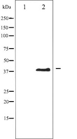 AURKB / Aurora-B Antibody - Western blot analysis of AurB phosphorylation expression in Nocodazole treated COS7 whole cells lysates. The lane on the left is treated with the antigen-specific peptide.