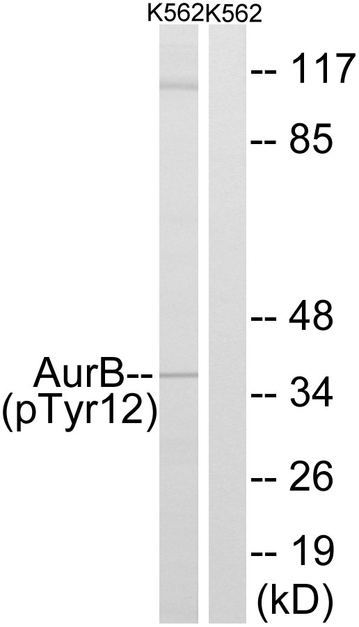AURKB / Aurora-B Antibody - Western blot analysis of lysates from K562 cells, using AurB (Phospho-Tyr12) Antibody. The lane on the right is blocked with the phospho peptide.