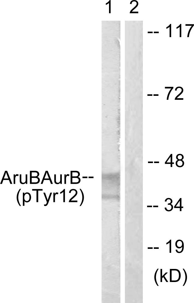 AURKB / Aurora-B Antibody - Western blot analysis of extracts from HepG2 cells, using AurB (Phospho-Tyr12) antibody.