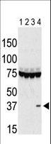 AURKC / Aurora C Antibody - The anti-Aurora C antibody is used in Western blot to detect Aurora C in lysates of 293 cells expressing Flag tag (lane 1), Flag-tagged Aurora A (lane 2), Flag-tagged Aurora B (lane 3), and Flag-tagged Aurora C (lane 4). Data is kindly provided by Drs. K. Sasai and S. Sen from the University of Texas MD Anderson Cancer Center (Houston, TX).