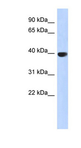 AURKC / Aurora C Antibody - AURKC / Aurora-C antibody Western blot of Fetal Pancreas lysate. This image was taken for the unconjugated form of this product. Other forms have not been tested.