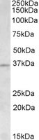AURKC / Aurora C Antibody - AURKC antibody (1.5 ug/ml) staining of Human Testis lysate (35 ug protein/ml in RIPA buffer). Primary incubation was 1 hour. Detected by chemiluminescence.
